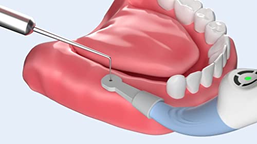 Детектор на зъбни импланти Триизмерен Локатор импланти Easydo-Детектор с 3 бр. Допир на Главата